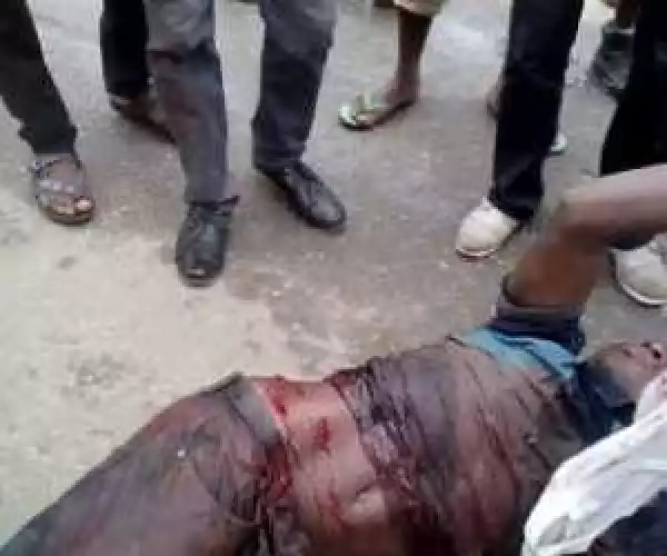 Not Again!! Police Shot Pro-Biafran Protester In Igweocha, Port-Harcourt [See Photos]